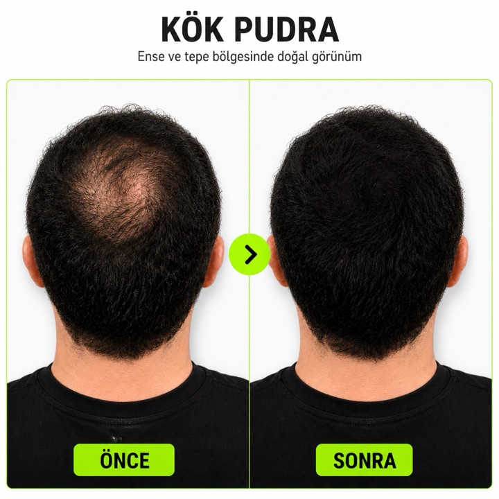 KökPudra Ense ve Tepe Bölgesinde Doğal Görünüm